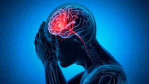 Image of: Exploring the Connection Between Brain Injury and Criminal Behavior