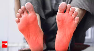 Image of: 7 Home Remedies to Relieve Burning Feet: Soothe Your Discomfort