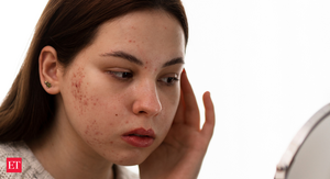 Image of: Understanding Your Skin: Signs of Internal Health Issues