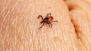 Image of: Understanding Alpha-Gal Syndrome: The Tick-Borne Red Meat Allergy