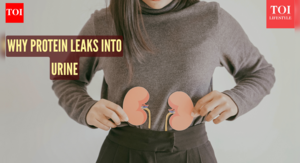 Image of: Understanding Proteinuria and Kidney Stones: Causes and Insights