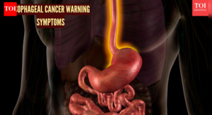 Image of: Recognizing the Early Signs of Esophageal Cancer